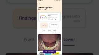 scanO AI Dental App YouTube Video
