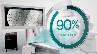 The New Standard in Lung Cancer Diagnostics