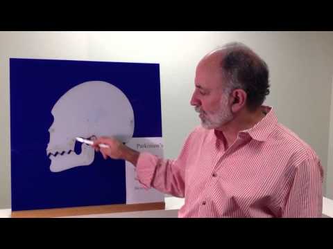 Dr. Jennings — Parkinson's TMJ Treatment Rationale