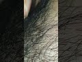 Ingrownhair Satisfying Hair Remove Asmr Hairstyle Trending Oddlysatisfying Waxing