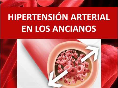 Tratamiento de la enfermedad degenerativa del disco cervical cuando la hipertensión ¿Cuál es el tratamiento de la hipertensión