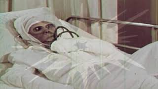 Tendinite - Nostrils