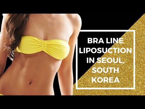 Watch the most Popular Package for Bra Line Liposuction in Seoul, South Korea