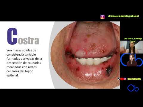 COSTRA