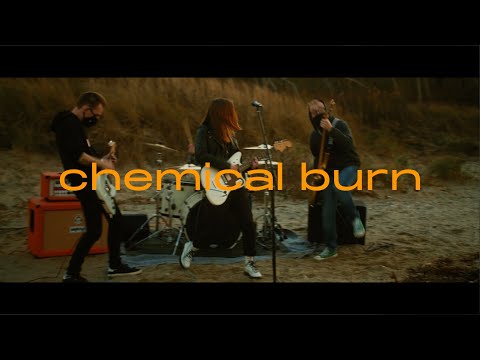 Video thumbnail for Chemical Burn
