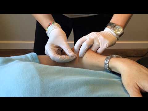 Body Works Sports Physiotherapy - What is IMS?