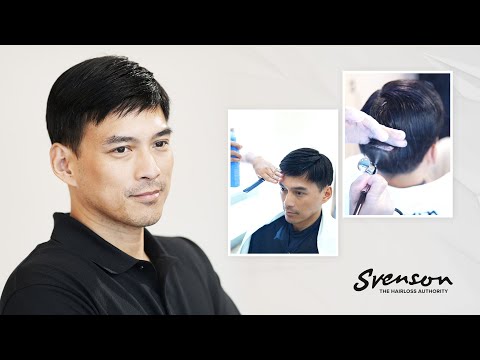 Svenson | Hair Restoration System