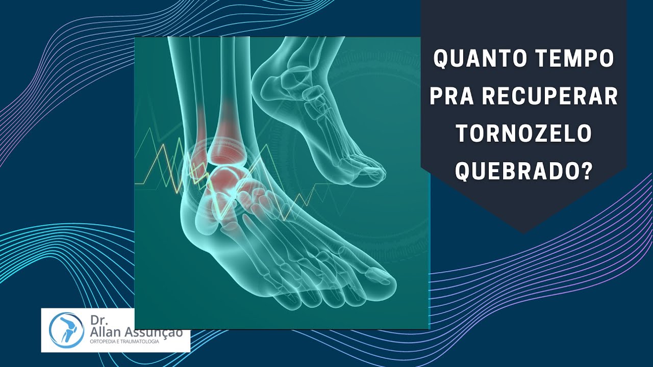 Quanto tempo se leva pra recuperar um tornozelo quebrado
