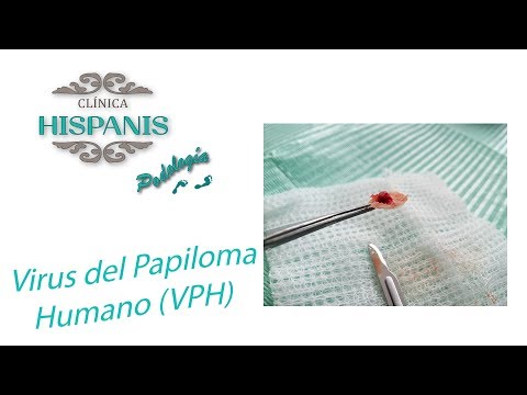 Papillomavirus und schwangerschaft