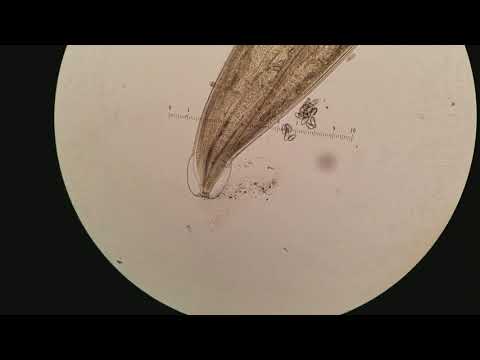 kombucha dysbiosis
