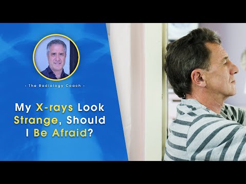 I felt a ZAP when getting x rays Is that possible