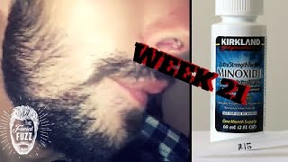 Minoxidil Beard | Week 21 | The Experiment | #Facialfuzzfridays