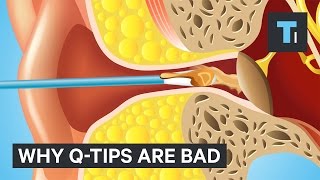 Why Q-Tips are bad