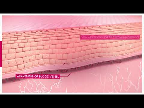 YouTube video cYv4n5L5ysQ