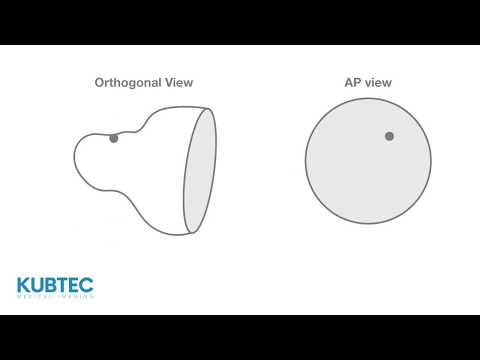 3-D Tomosynthesis - The Next Generation of Imaging Technology - 01.17.18