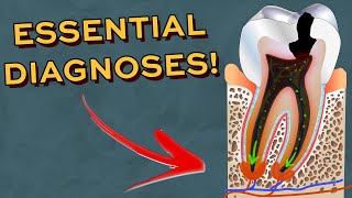 Every Dentistry Diagnoses you NEED to know when seeing patients!