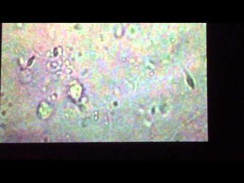 Aula de espermograma -  Prof° Diotto e Dra Lais - 1° Amostra