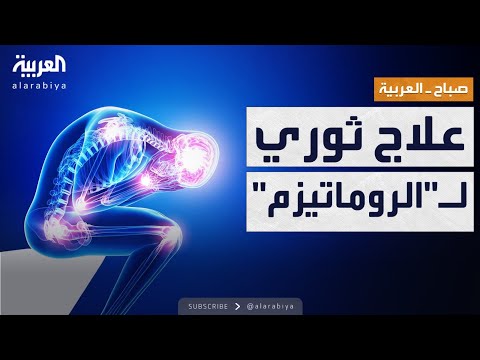 فيديو | صباح العربية | الإعلان عن علاج ثوري لمرض الروماتيزم.. والنتائج قوية