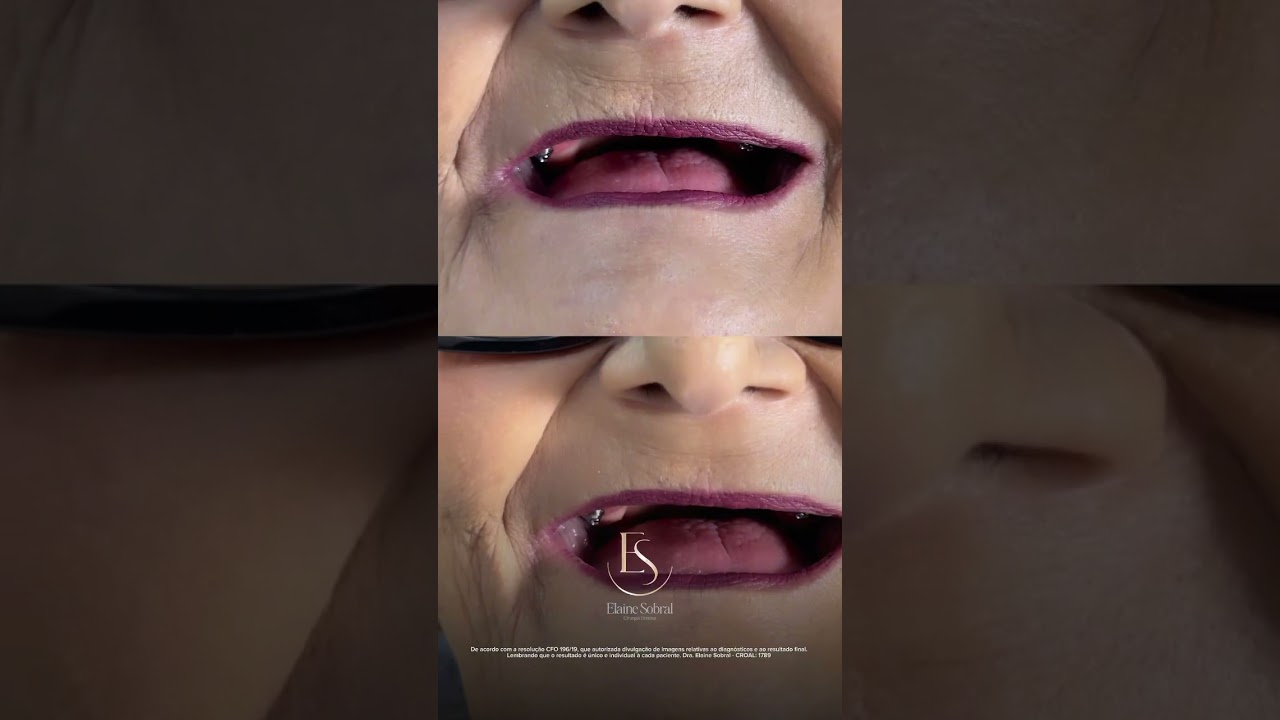 Elaine Sobral Leite-26