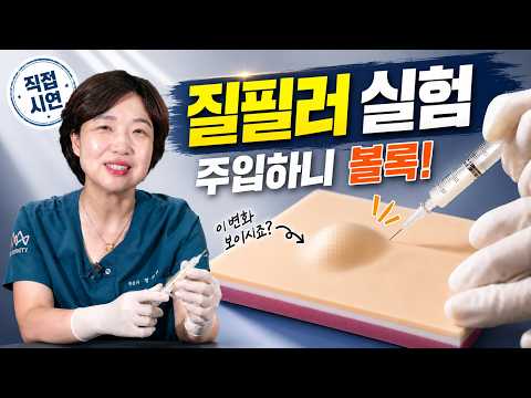 질필러 영상 | 트리니티TV