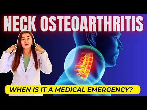 CERVICAL SPONDYLOSIS: 5 Things You Can Do To Get Rid Of Neck Pain Fast! | Doc Cherry
