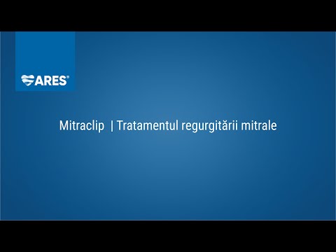 Mitraclip  | Tratamentul regurgitării mitrale | ARES | Inovație în cardiologie