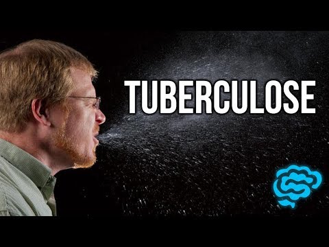 🔴 L'EXPLICATION LA PLUS CLAIRE DE TUBERCULOSE (2017) ! - DR ASTUCE