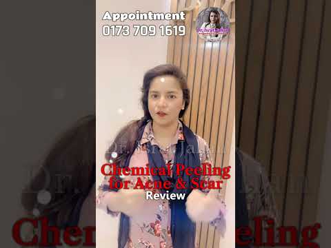 Chemical peels can improve the skin's Appearance - Reviews