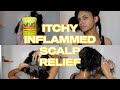 SULFUR 8 & WATER SAVED MY ITCHY SCALP! | Seborrheic Dermatitis Relief + Wash Day Routine (ASMR)