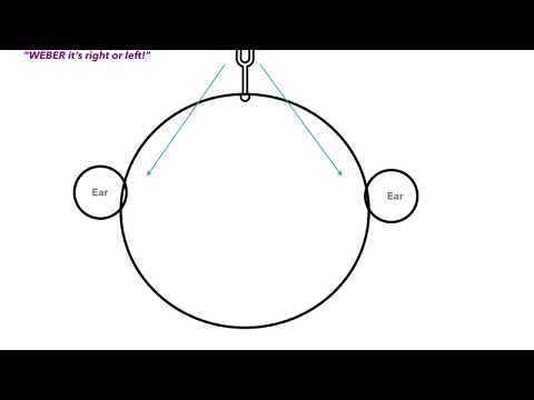 Weber vs. Rinne Test & Conductive vs. Sensorineural Hearing Loss