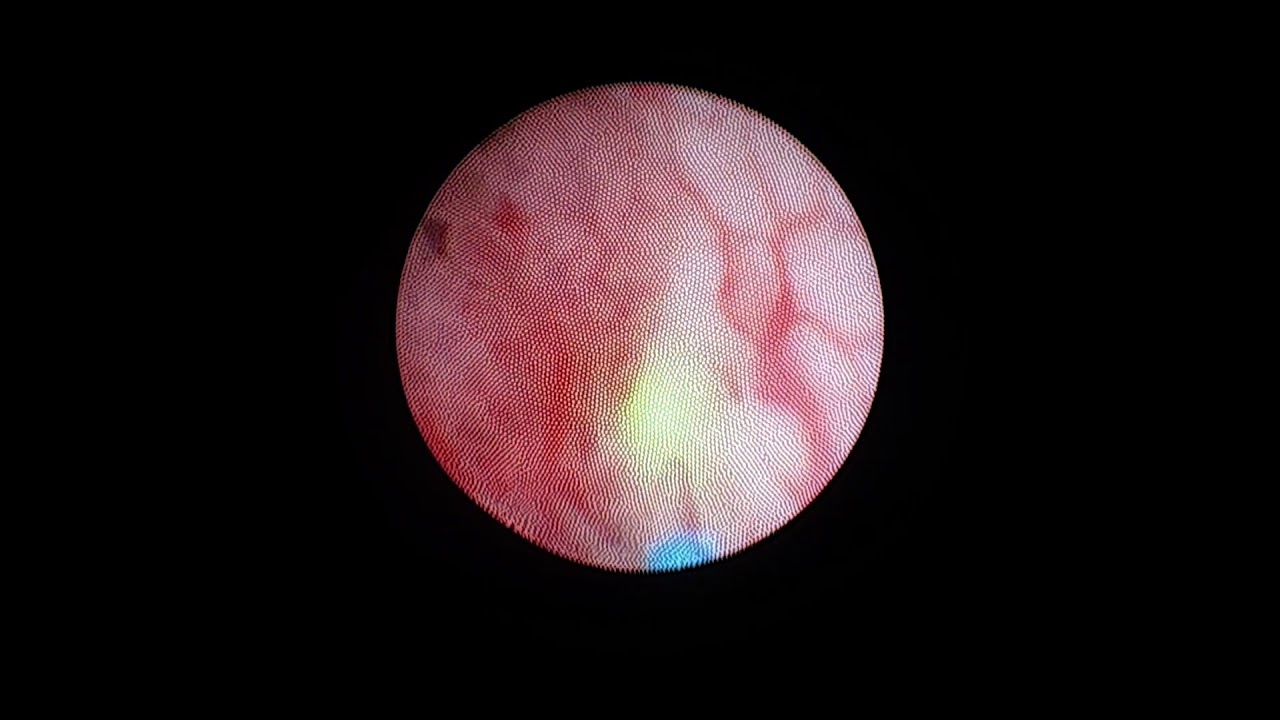 Hassan Beltran Del Rio-22