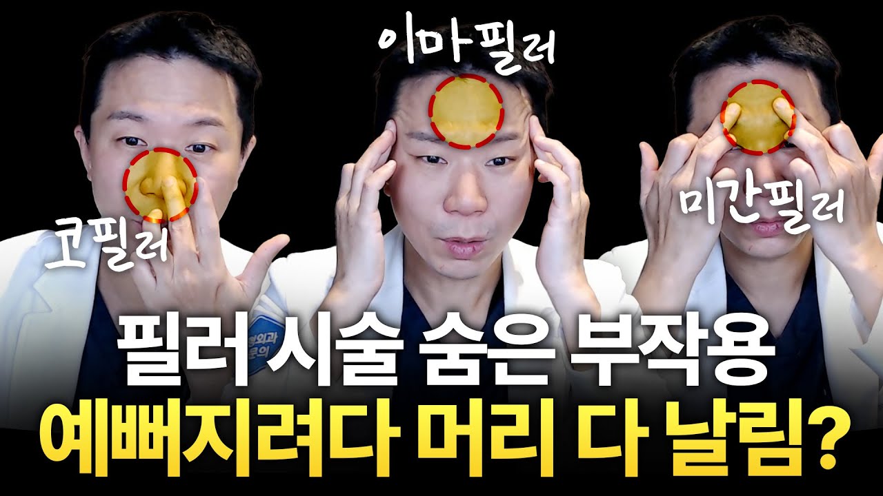 필러 맞기 전에 꼭 보세요 (의외의 부작용)