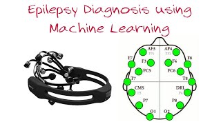 Epilepsy classification using  Welch power spectral density (Complete EEG tutorial)
