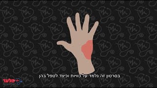 כוויות | מלער קורס עזרה ראשונה
