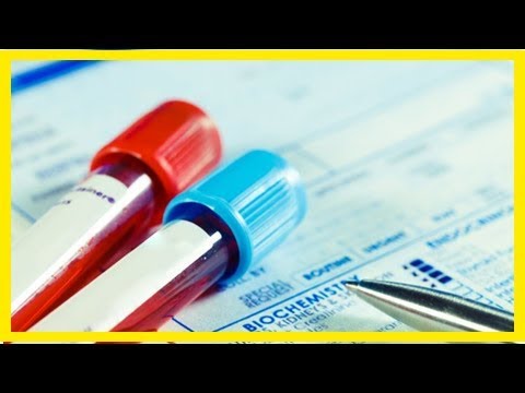 Il Ministero della sanità dichiara che 97 persone sono infettate da parassiti pericolosi Mostrare quello che ci sono vermi