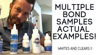 Hair replacement Men's Hair System Review 5 Different Bonds, Actual Examples