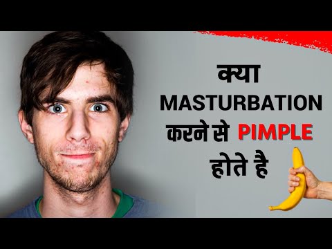 क्या हस्तमैथुन करने से Pimple होते है | काश हर लड़का एक बार इस वीडियो को देख ले