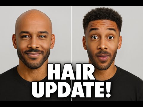 I Can’t Believe My Hair Looks Like This Now… (Bald Update)