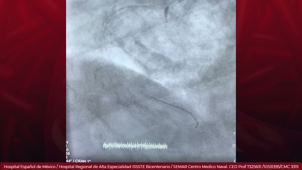 Marcelo Utrera Lagunas-114