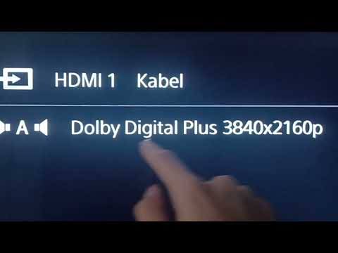 Giga TV Box 2 Anschließen & Einrichten