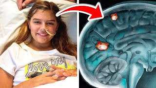 Girl Who Survived Brain-Eating Amoeba Swims Again