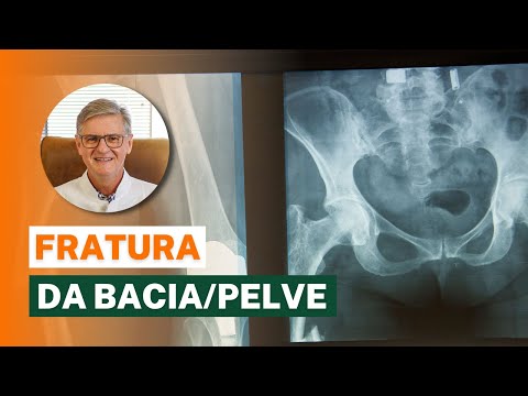 Fratura na Bacia/Pelve - O Que Fazer? (Sintomas, Diagnóstico e Tratamento)