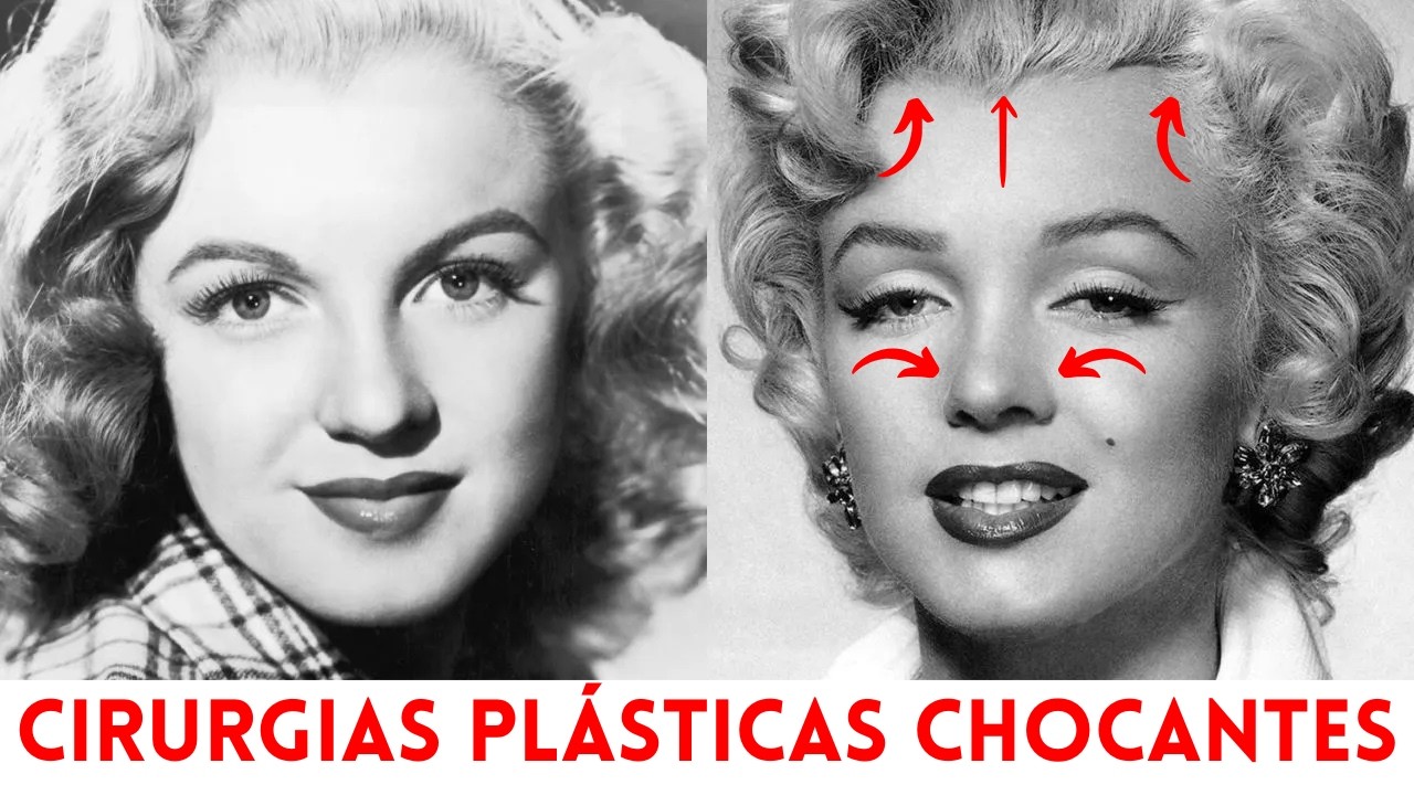 18 estrelas clássicas de Hollywood que fizeram cirurgia plástica