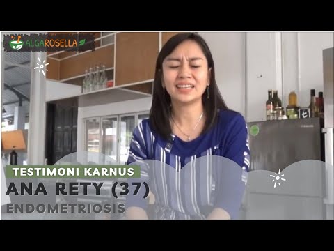 Endometriosis Dekat Rektum, Sembuh Tanpa Operasi