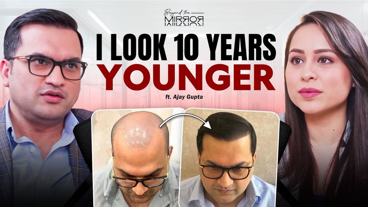 Ajay on early hair loss and finally choosing a transplant, full interview