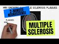2-Minute Neuroscience: Multiple Sclerosis
