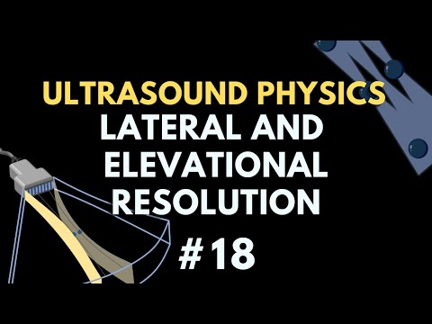 Lateral and Elevational Resolution | Ultrasound Physics | Radiology Physics Course #18