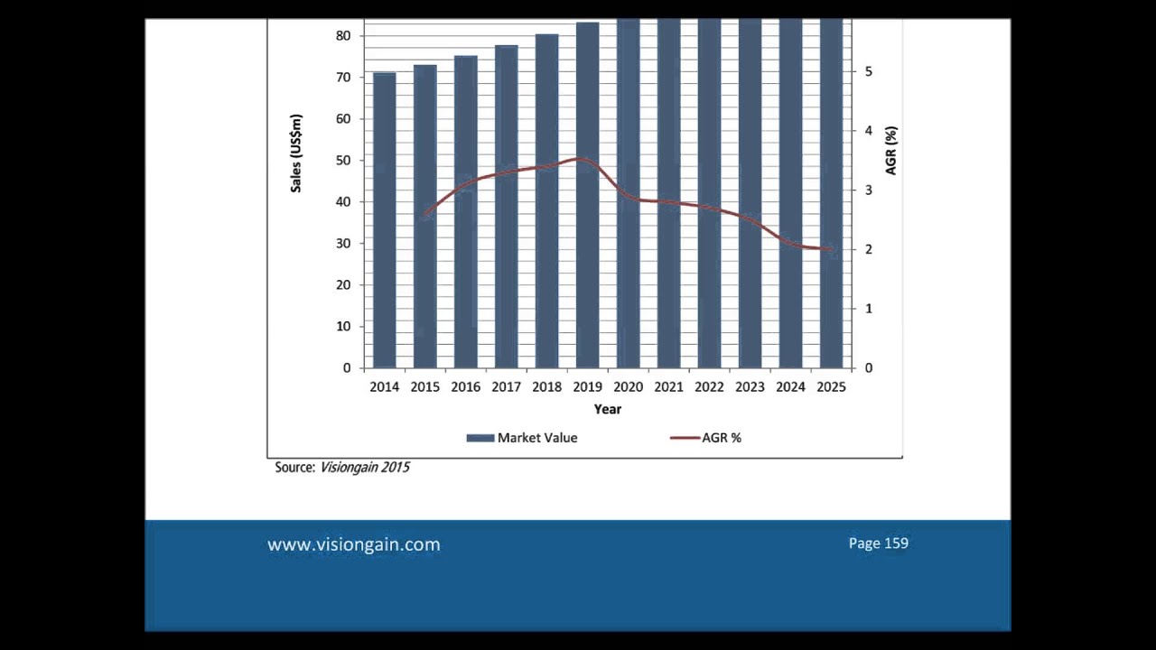 Military Radar Systems Market 2015-2025 Report