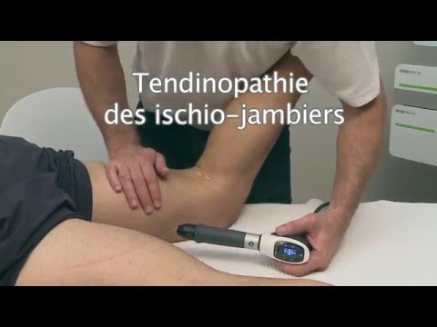 download lagu mp3 mp4 Tendinite Ischio Jambier Fessier, download lagu Tendinite Ischio Jambier Fessier gratis, unduh video klip Tendinite Ischio Jambier Fessier