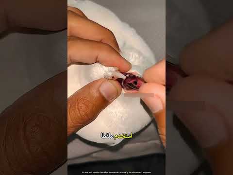 عملية إنقاذ ذكية لحمامة ابتلعت خيطاً طويلاً 🕊️🧵